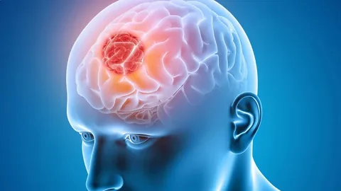 Ilustração de lesões cerebrais tratadas por neurocirurgião