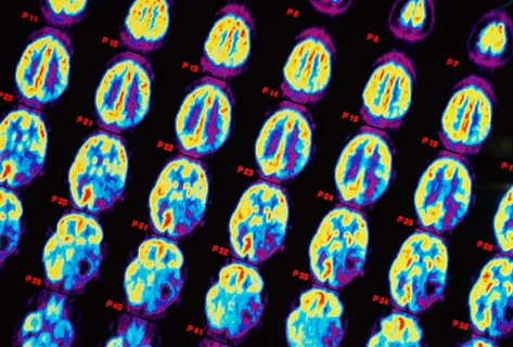 Médico analisando exame de imagem para diagnóstico neurológico