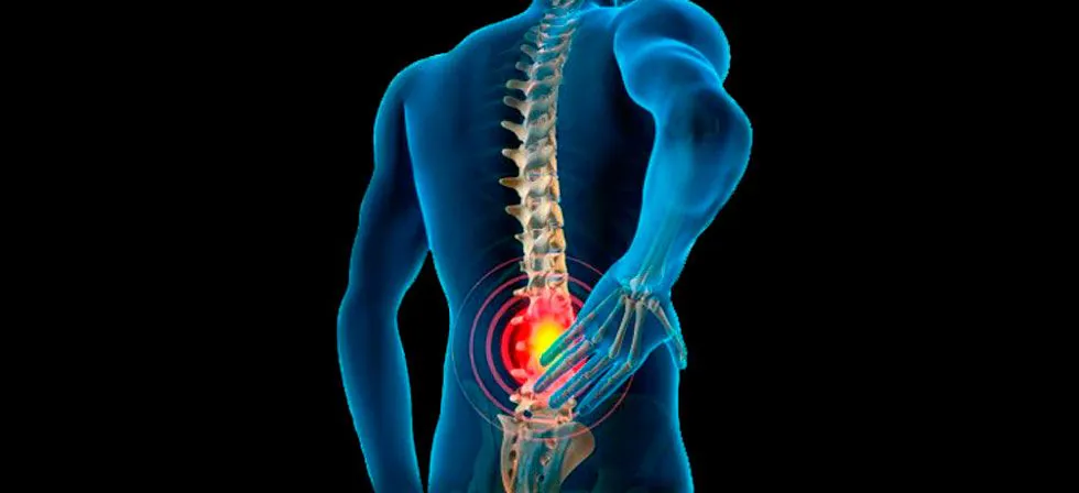 Paciente que pode se beneficiar da cirurgia endoscópica da coluna